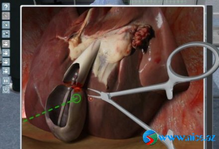 Chirurgie-Simulator 2011